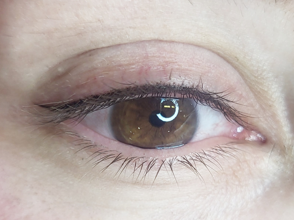 Intensification Ciliaire